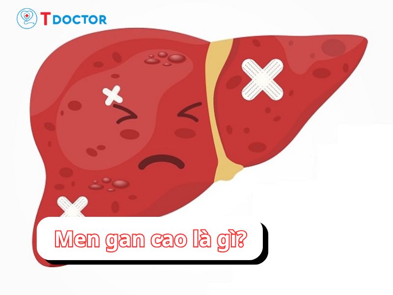 Tất tần tật thông tin về men gan cao
