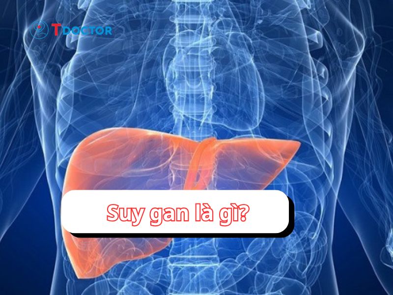 Tất tần tật thông tin về bệnh suy gan bạn nhất định phải biết