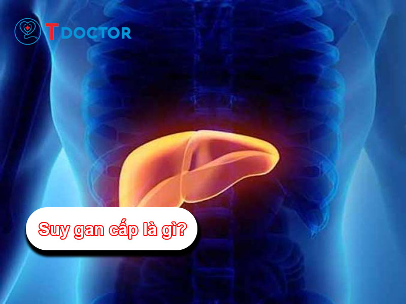 Suy gan cấp: Bệnh lý nguy hiểm và cách phòng ngừa