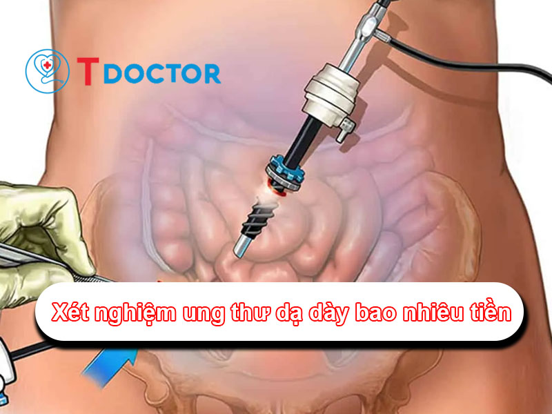 Trả lời câu hỏi "Xét nghiệm ung thư dạ dày bao nhiêu tiền?"