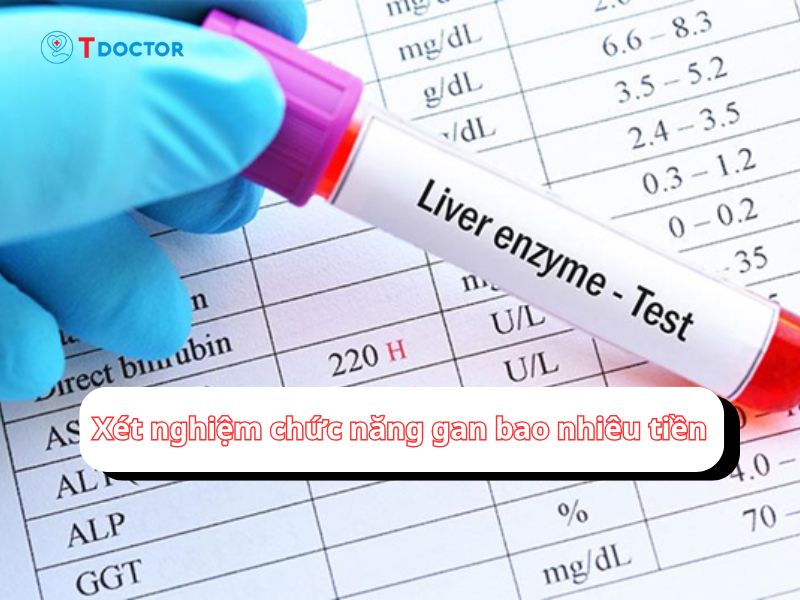Bật mí "Xét nghiệm chức năng gan bao nhiêu tiền?" 