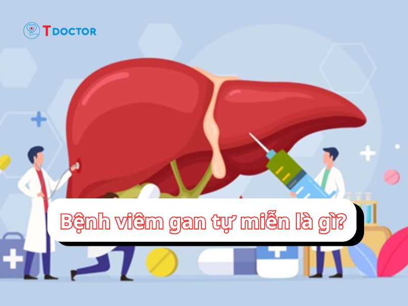  Viêm gan tự miễn và những điều nhất định cần biết