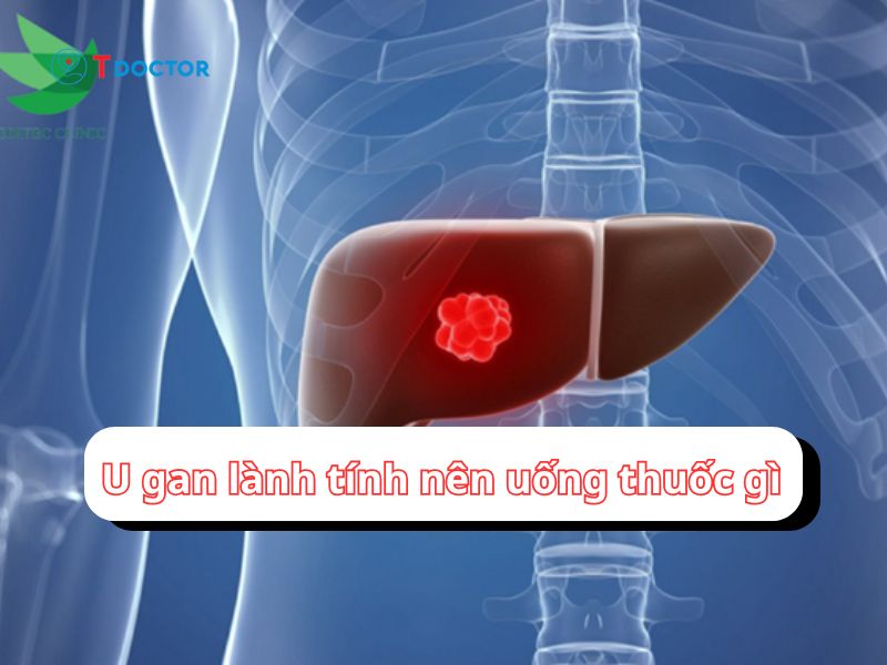 Bật mí u gan lành tính nên uống thuốc gì 