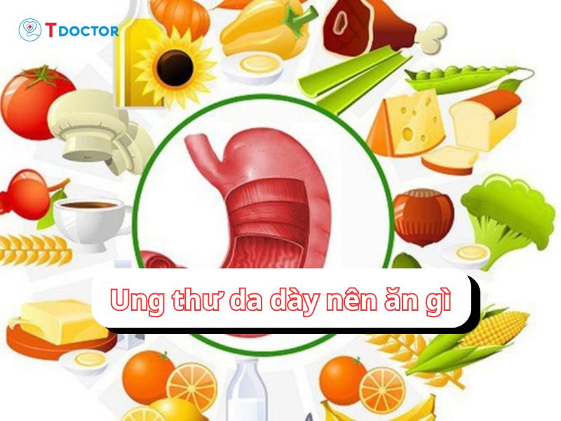 Bật mí ung thư dạ dày nên ăn gì
