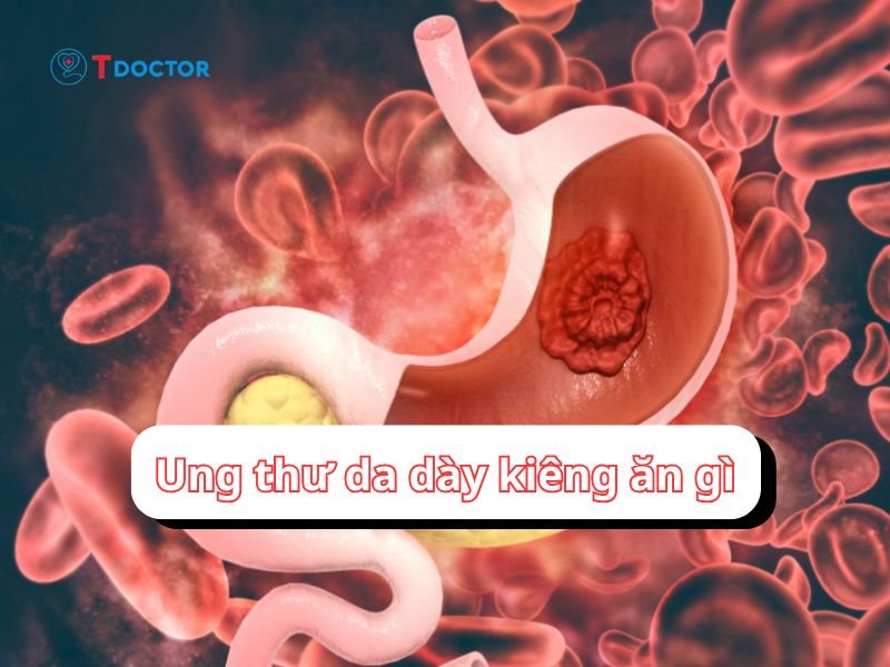 Mách bạn ung thư dạ dày kiêng ăn gì?