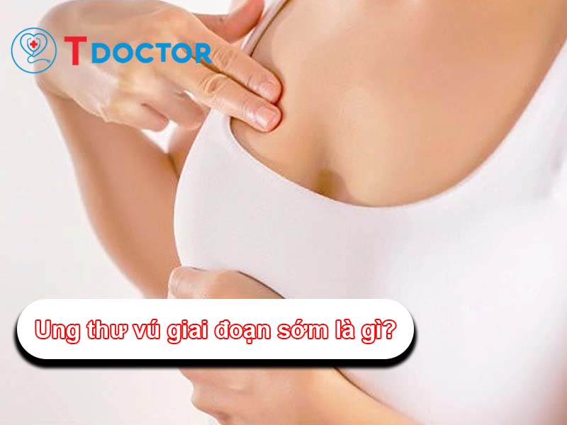 Ung thư vú giai đoạn sớm là gì? những dấu hiệu của bệnh