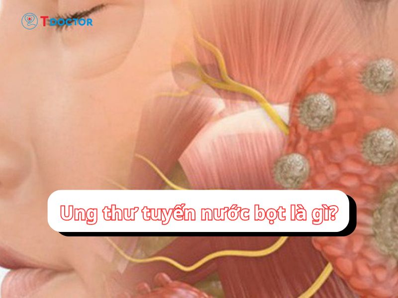 Tất tần tật thông tin bạn cần biết về ung thư tuyến nước bọt