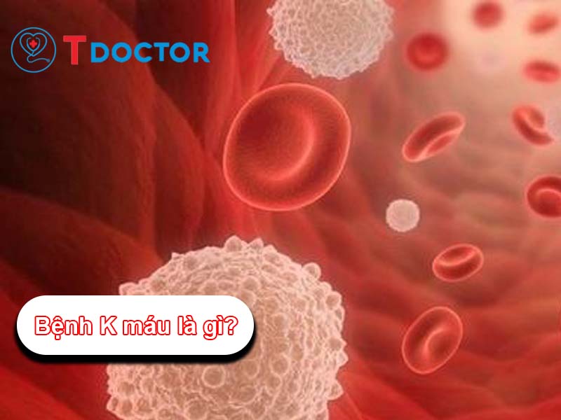 Bệnh K máu là gì? Những dấu hiệu của người mắc K máu