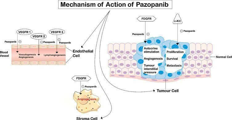 Hy vọng mới trong điều trị ung thư thận và Sarcoma mô mềm tiến triển