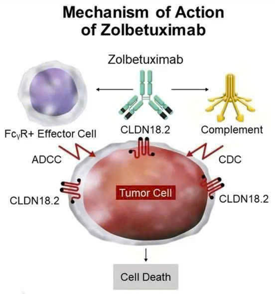 Mục tiêu sinh học mới thay đổi chiến lược điều trị ung thư dạ dày