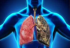 Ung thư gan – Nguyên nhân, dấu hiệu và phương pháp điều trị