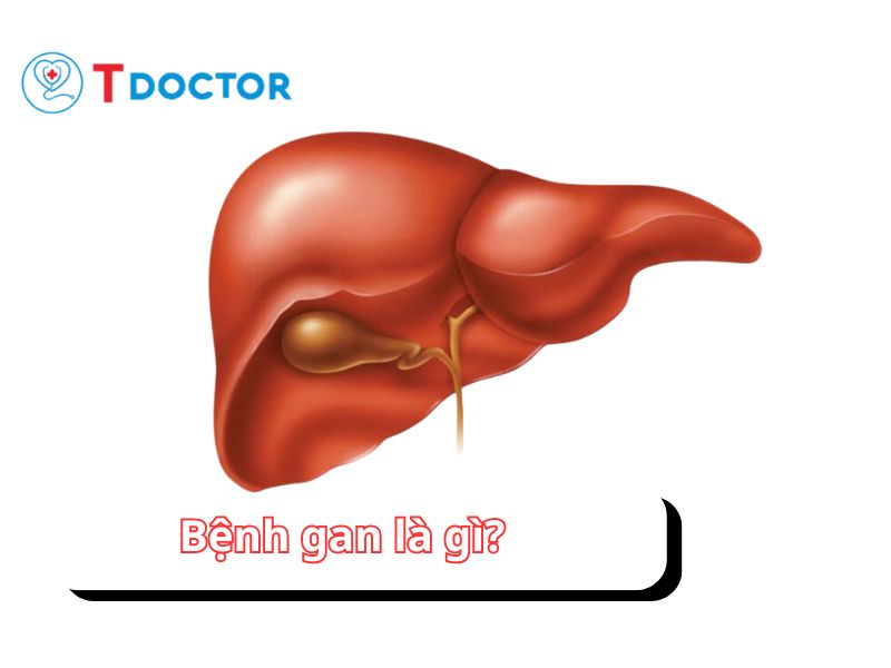 Tất tần tật thông tin bạn cần biết bề bệnh gan 