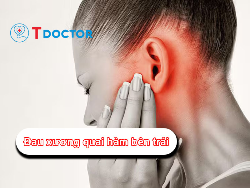 Nguyên nhân và điều trị tình trạng đau xương quai hàm bên trái