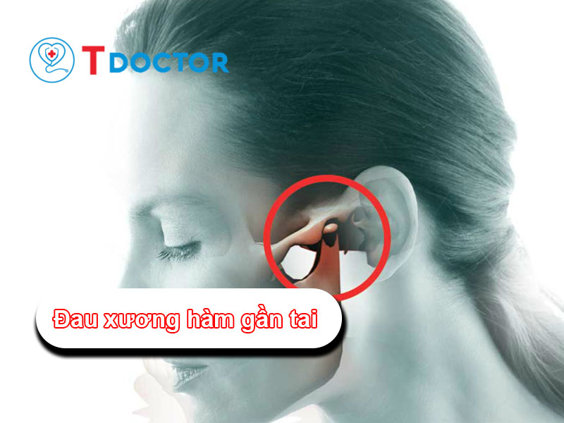 Các nguyên nhân gây đau xương hàm gần tai phải, trái