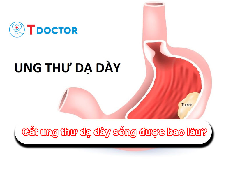 cat-ung-thu-da-day-song-duoc-bao-lau