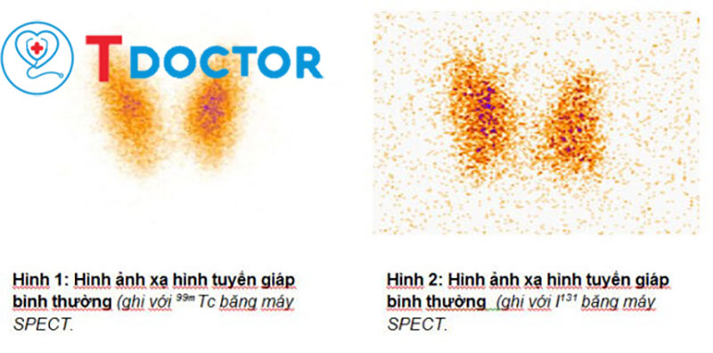 k-tuyen-giap-giai-doan-dau1