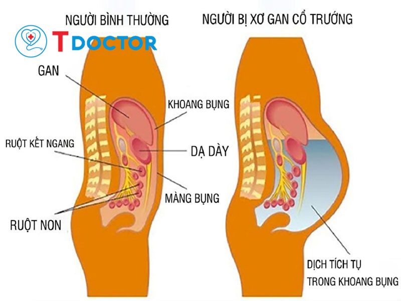 xo-gan-co-truong-la-gi