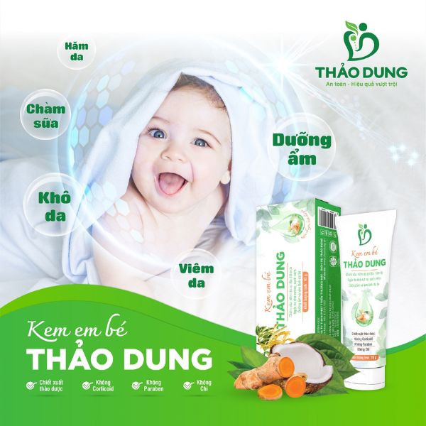 Kem em bé Thảo Dung làm lành da, dưỡng ẩm da em bé hiệu quả
