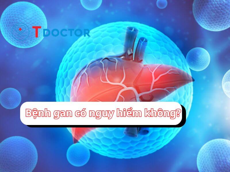 Bệnh gan có nguy hiểm không và những điều cần biết.