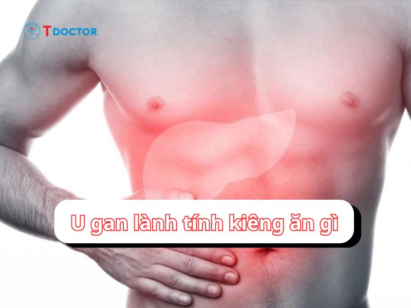 Bật mí u gan lành tính kiêng ăn gì