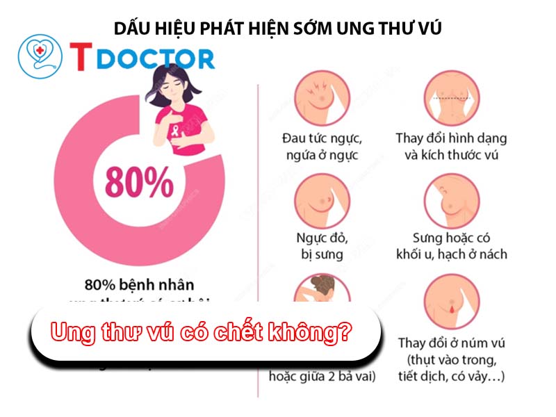 Trả lời câu hỏi "Ung thư vú có chết không" và điều cần biết