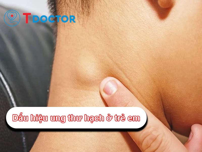 Dấu hiệu ung thư hạch ở trẻ em: Cách nhận biết và xử lý kịp thời